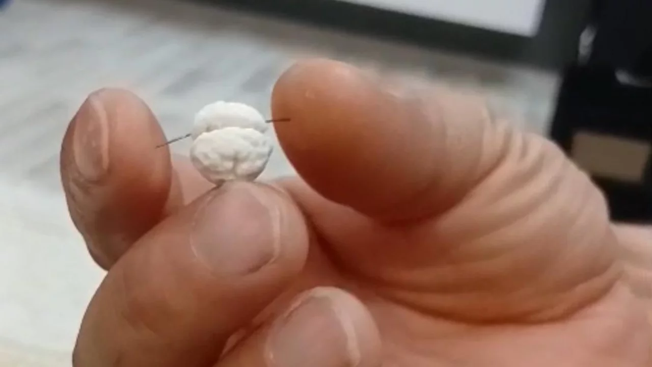 Bir aileyi hayrete d&uuml;ş&uuml;ren olay: Dikkati faciayı &ouml;nledi!