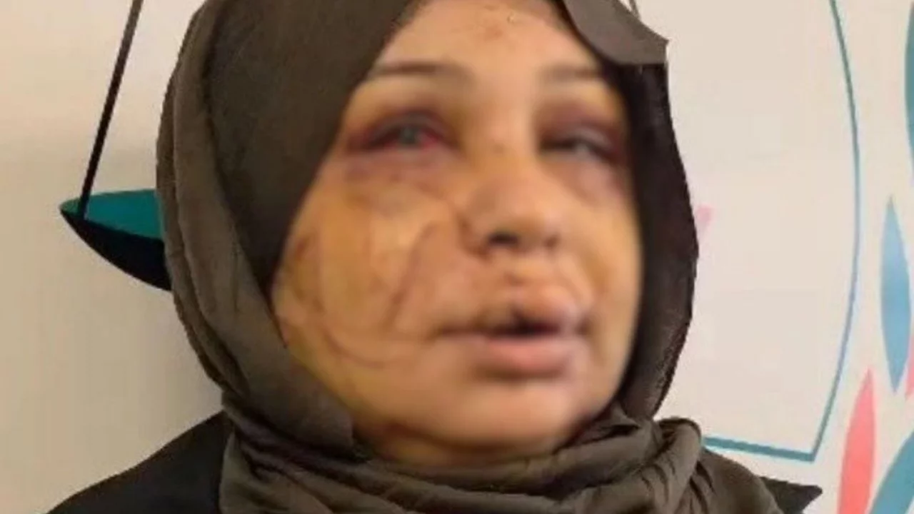 Eşini yaralayan polis memurunun dosyası, ağır cezaya g&ouml;nderildi