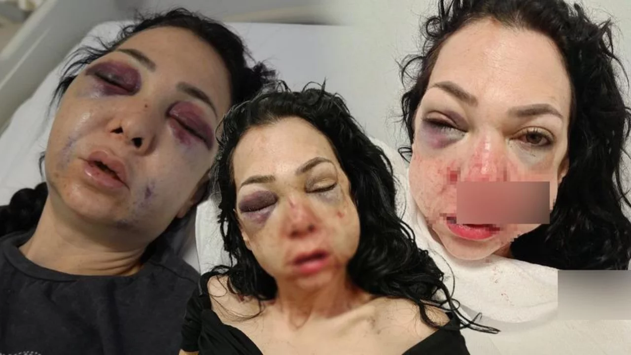 T&uuml;rkiye bu olayı konuşuyor! Anne ve oğlunu feci şekilde darp ettiler...
