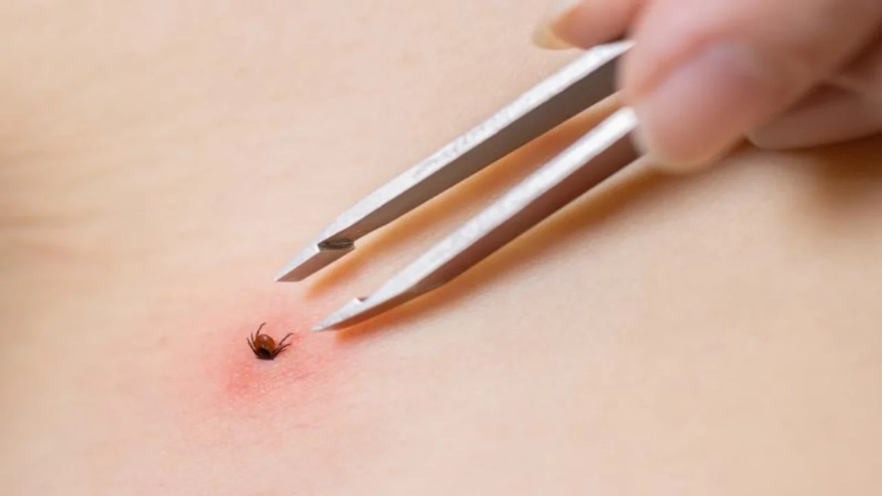 Uzman isimden "KKKA" uyarısı: Yağışlı kış kene sayısını...