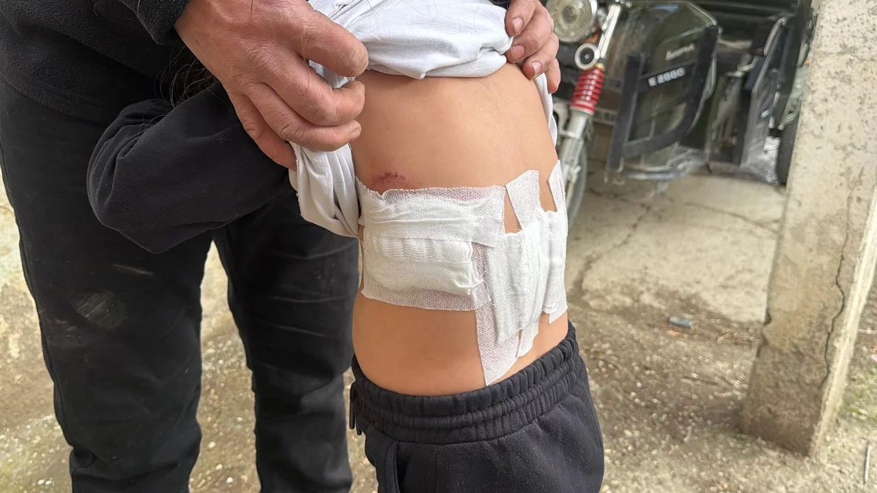 Saldırgan eşek 5 yaşındaki &ccedil;ocuğa kabusu yaşattı
