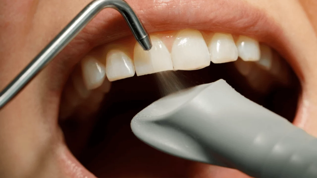 Sosyal medya üzerinde satılan diş parlatıcı ve benzeri ...