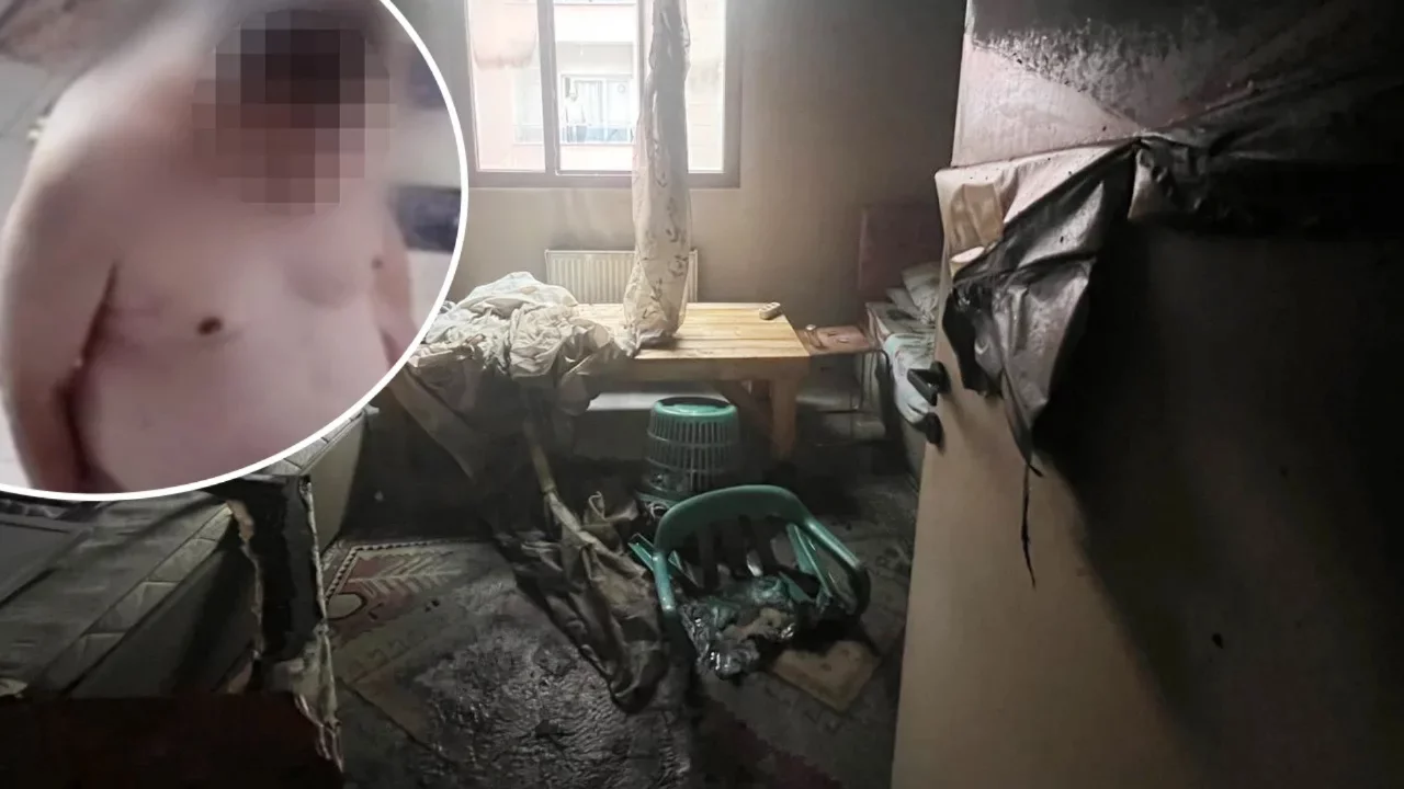 Evini ateşe verip ka&ccedil;tı, yakalandığı anda kalp krizinden &ouml;ld&uuml;