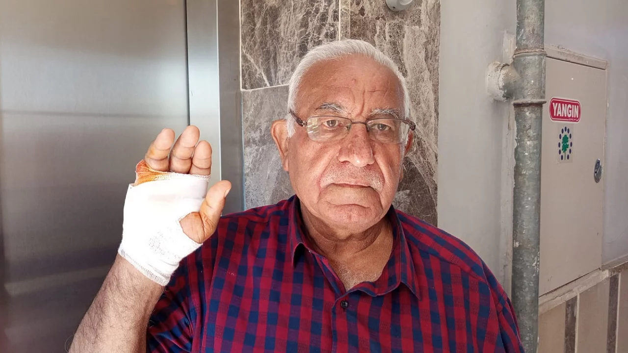 En sevdiği komşusu parmağını ısırarak kopardı 