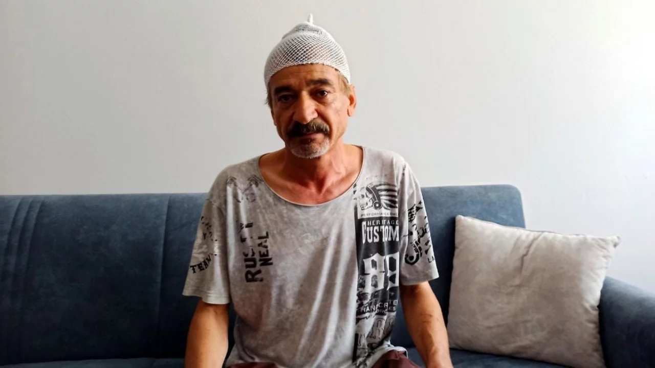 Çay içerken başına beton parçası düştü