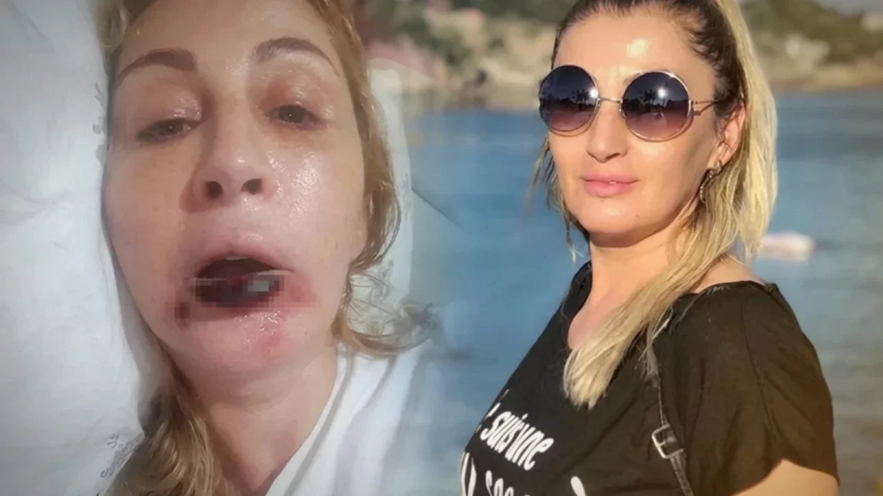 Güzellik merkezine gitti hayatı karardı! 