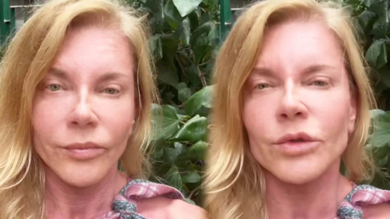 Biricik Suden'den estetik iddialarına dikkat &ccedil;eken tepki: "Yapılan işlem belli, abartmaya gerek yok"