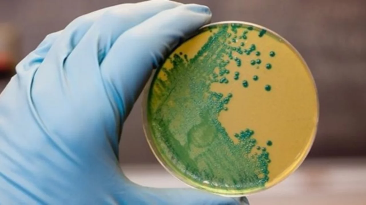 Buzdolabında bile çoğalıyor! Uzmanlardan Listeria bakterisi uyarısı