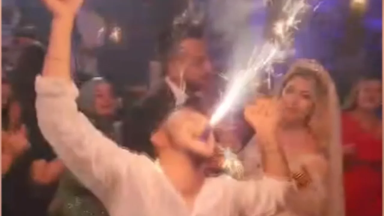 Düğün eğlencesi kötü bitti! Meşale ağzında patladı...