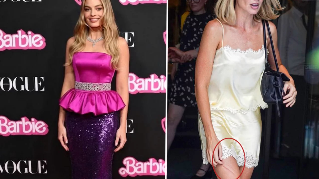 Barbie yıldızı Margot Robbie'nin bacağındaki morluk hayranlarını endişelendirdi