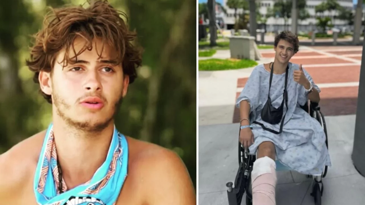 Survivor'da bacağını kaybeden yarışmacıdan yeni paylaşım: Yeni hayatına alışmaya &ccedil;alışıyor