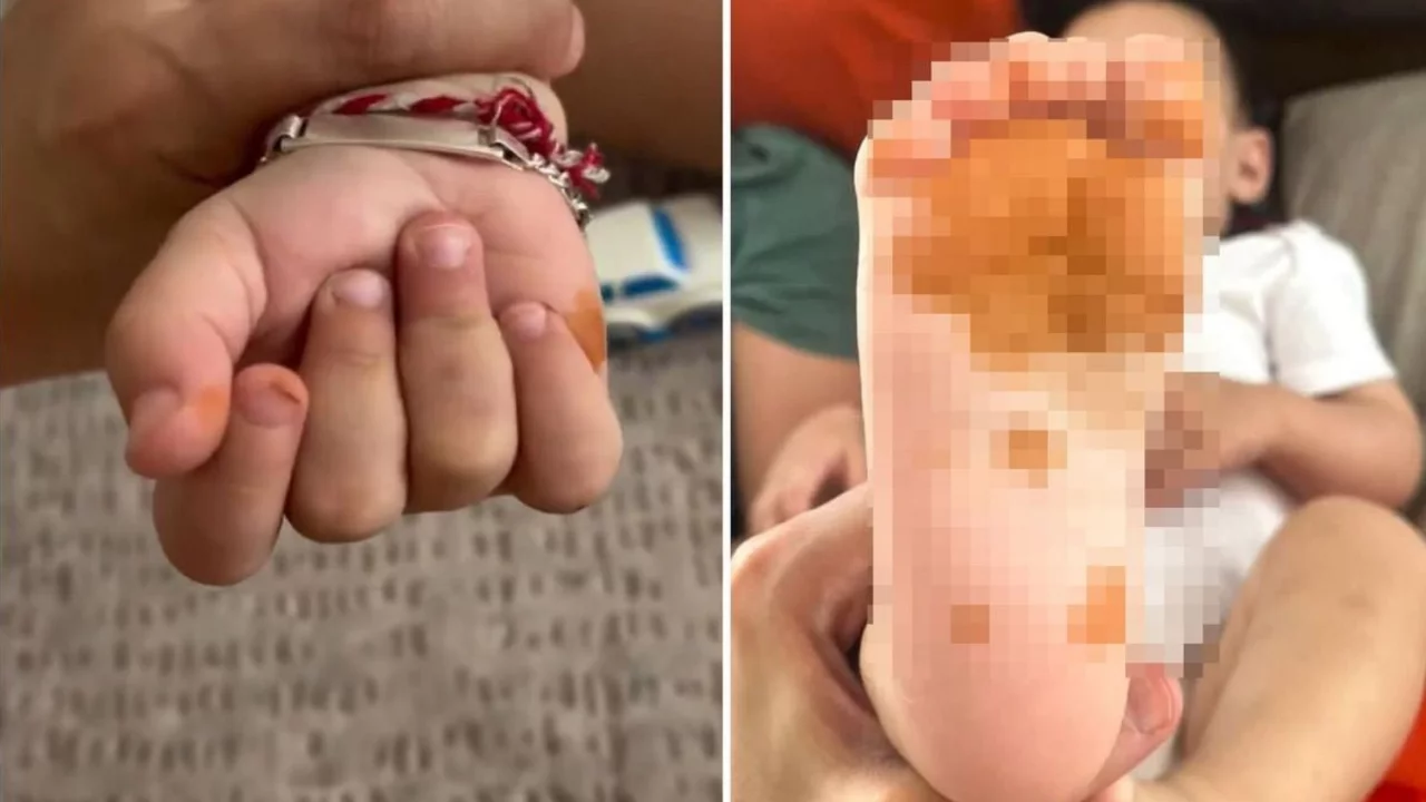 Sabah uyandığında çocuğunun eline ayağına bakan anne şoke oldu!