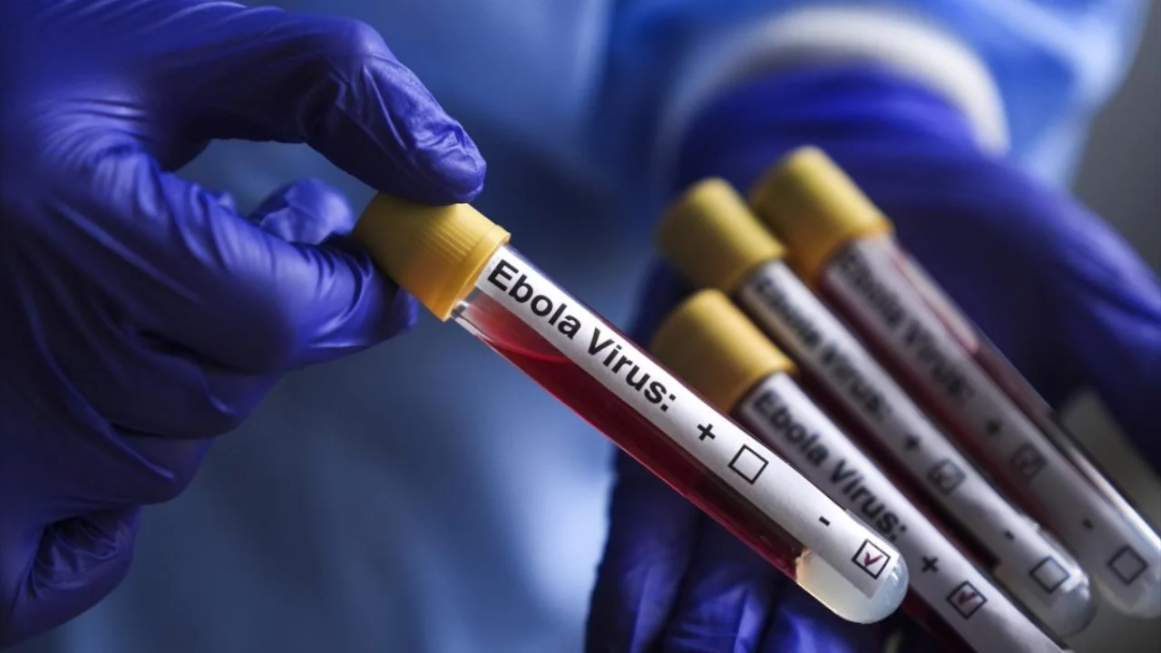 DSÖ: KDC'de Ebola salgını, uluslararası öneme sahip "halk sağlığı acil durumu" olmaya devam ediyor 
