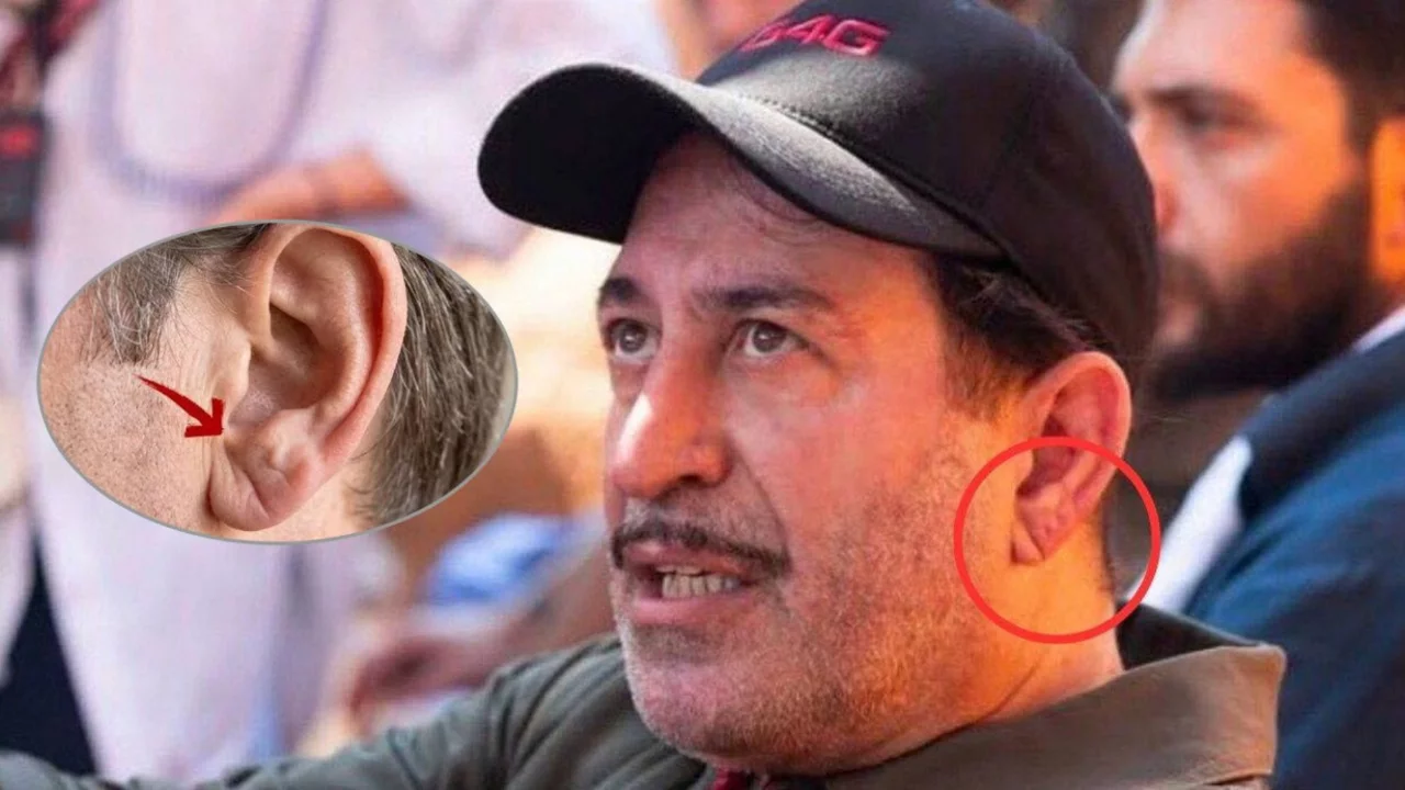 Cem Yılmaz'ın rahatsızlığı sonrası g&uuml;ndeme geldi: 'Frank işareti' kalp krizinin sessiz belirtisi mi?