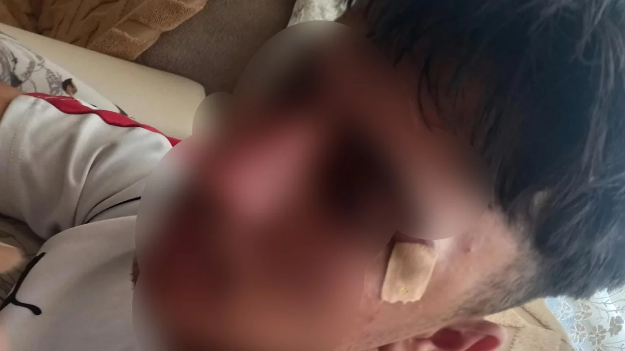 Mesleki eğitim merkezinde şoke eden olay! &Ouml;ğretmenin kafa attığı &ouml;ğrenci hastanelik oldu...