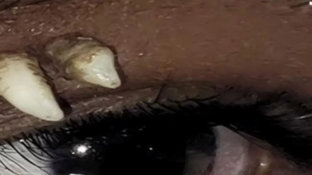 Tıp tarihinde bir ilk! Muayene eden doktorlar bile inanamadı