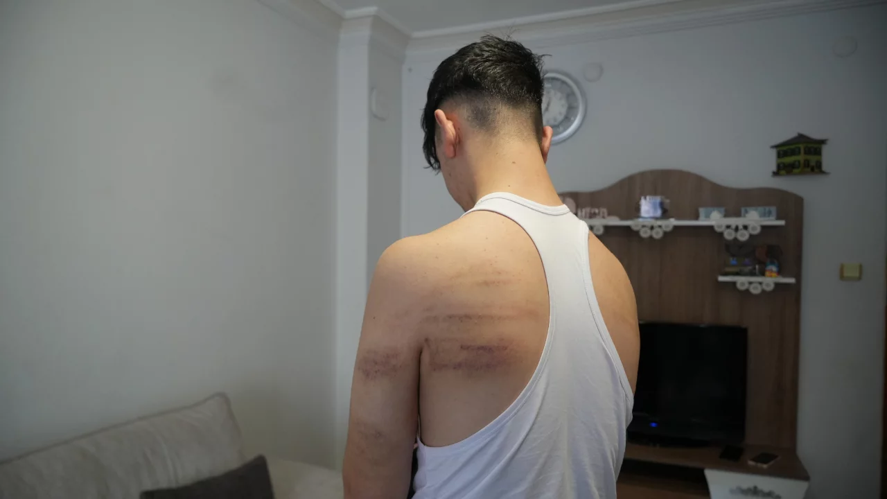15 yaşındaki berber çırağına darp iddiası: Önce dövdü, sonra temizlik yaptırdı
