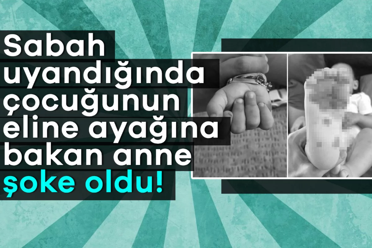 Sabah uyandığında çocuğunun eline ayağına bakan anne şoke oldu!