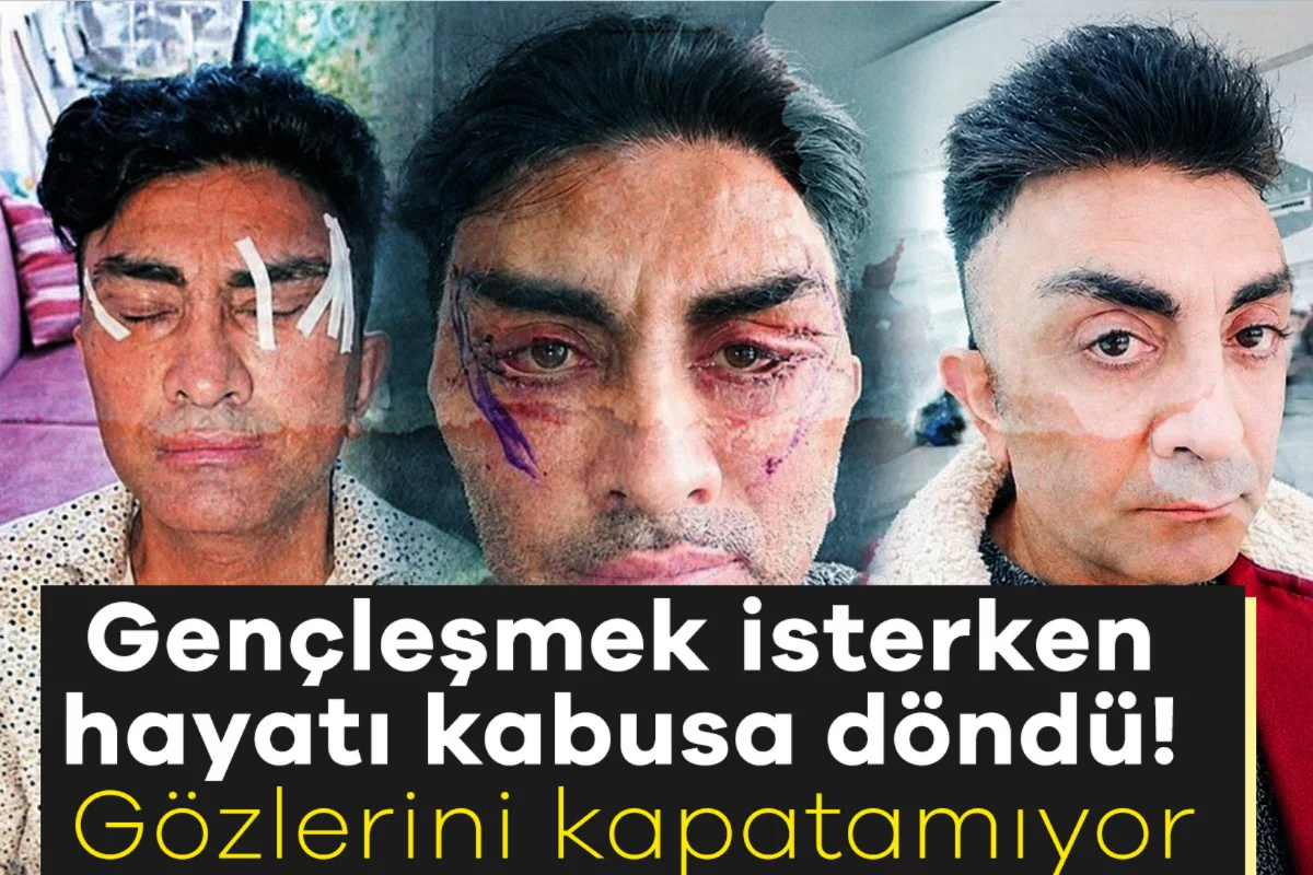 Gençleşmek isterken hayatı kabusa döndü! Gözlerini kapatamıyor