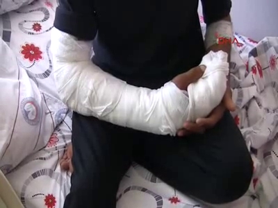 Kopan parmakları ameliyat'la yerine dikildi