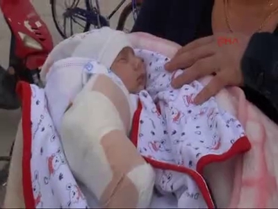 Solunum rahatsızlığı nedeniyle hastaneye götürülen 35 günlük bebeğin kolu kırıldı