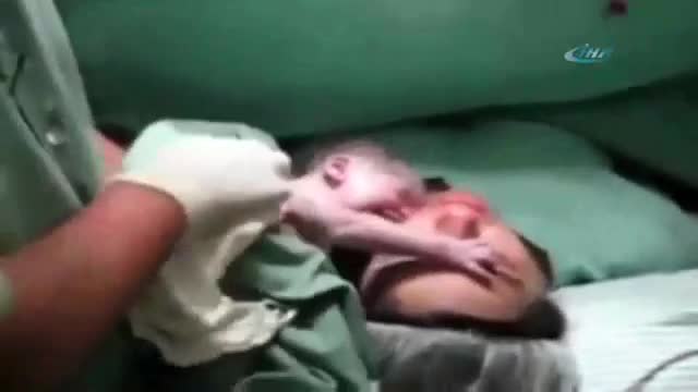 Tek isteği annesinden ayrılmamak