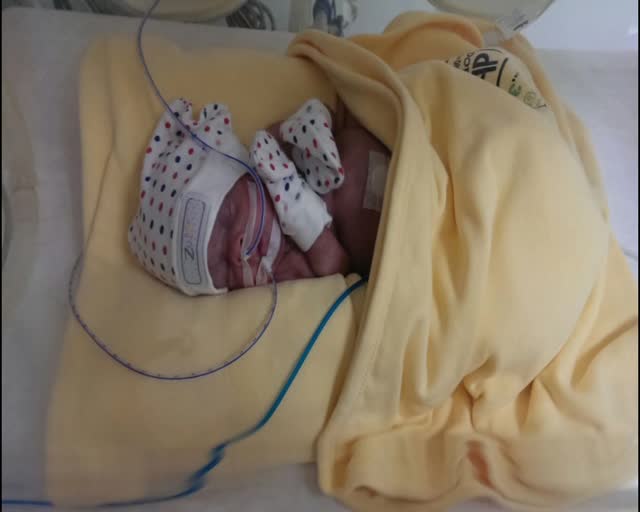 Bursa'da yaşamaz denilen parmak bebek hayata tutundu