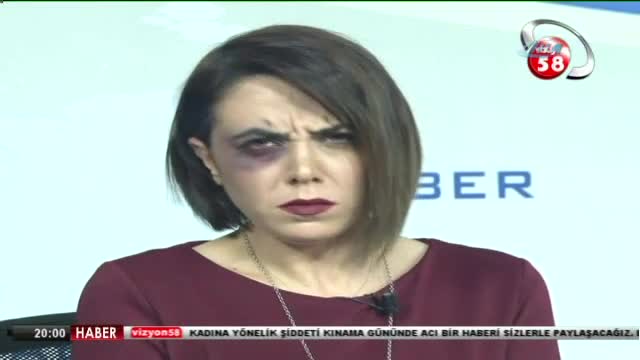 Canlı yayına morarmış gözle çıktı