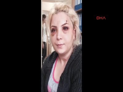 'Eski kocam dövdü' diye karakola gitti, cinayetten tutuklandı