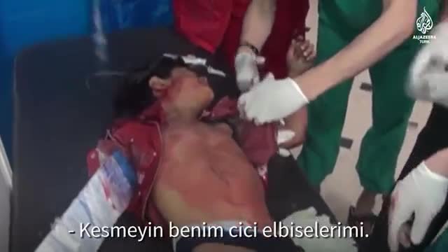 Halepli çocuk: Kesmeyin cici kıyafetlerimi