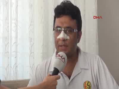 Sendika başkanına 'Burun kırma' suçlaması