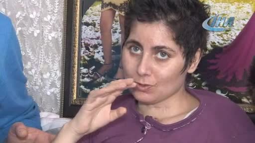 İş kazası ile hayatı değişti