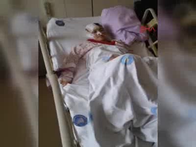 Fuhuşa zorlanıp öldüresiye dövülen Kırgız kadın 35 gün sonra konuştu