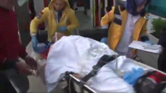 İbrahim Erkal'ın doktorundan açıklama