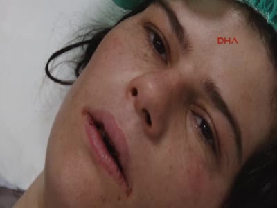Suriyeli kadını, kocası levyeyle dövüp dişlerini söktü