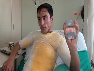 Üniversite öğrencisini kaynar suyla haşladılar