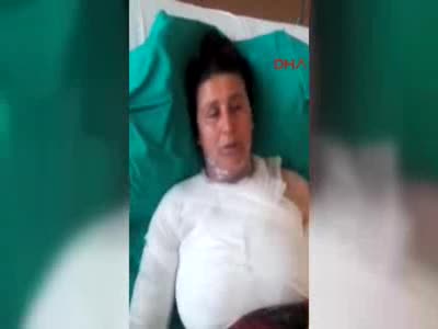 Bursa'da kocasının sevgilisi tarafından üzerine sıcak su döküldü