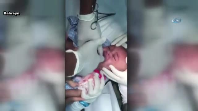 Boğazına saat kordonu kaçan çocuk, böyle kurtarıldı