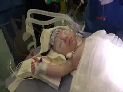 Bursa'da 5 aylık Hüseyin bebek, ithal doktor ile yaşama tutundu