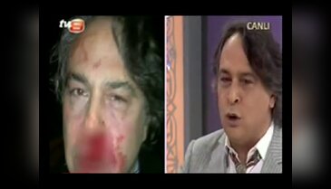 Barbaros Şansal saldırıya uğradı