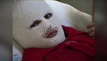 Piknik faciaya dönüştü