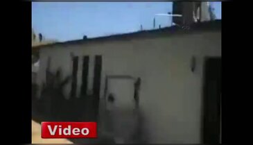Havuza atlarken ayağını kırdı