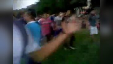 Kapsül gözünü kör etti