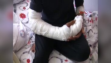 Kopan parmakları ameliyat'la yerine dikildi