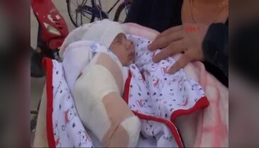 Solunum rahatsızlığı nedeniyle hastaneye götürülen 35 günlük bebeğin kolu kırıldı