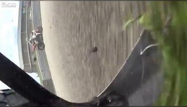 Yüzüne motosiklet çarptı!