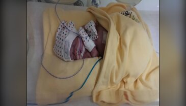 Bursa'da yaşamaz denilen parmak bebek hayata tutundu