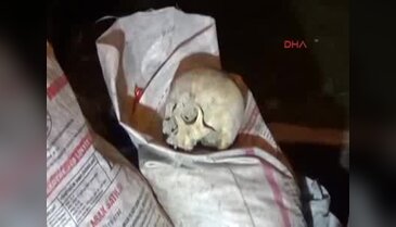 Uşak'ta çöp konteynerinde insana ait kafatası bulundu