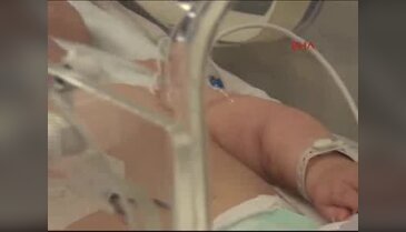 Bebek kaçırmaya mikroçipli bileklik önlemi