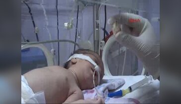 3 günlük bebeğin yemek borusundan taş çıktı